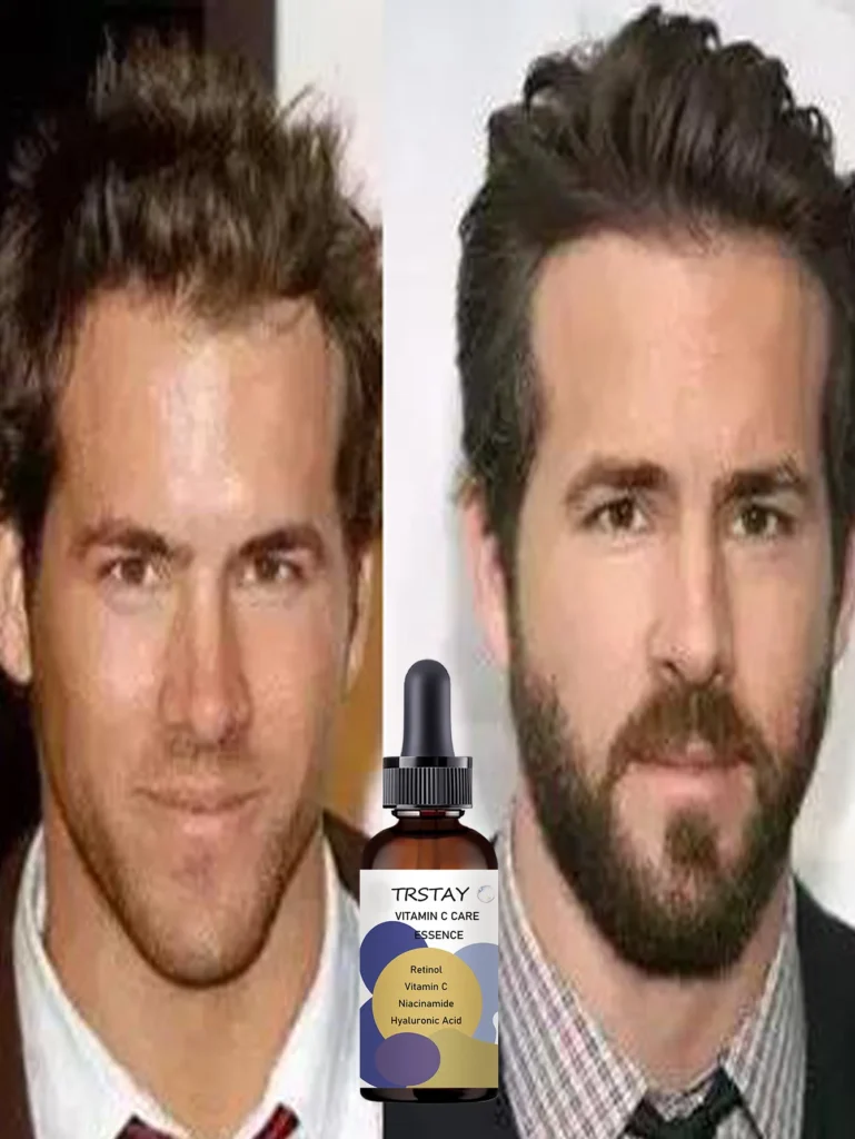 Top Beard Oils to Strengthen and Nourish Your Facial Hair for a Polished Look