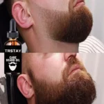 Top Nourishing Beard Serum for Thicker, Healthier Mustache and Easy Styling