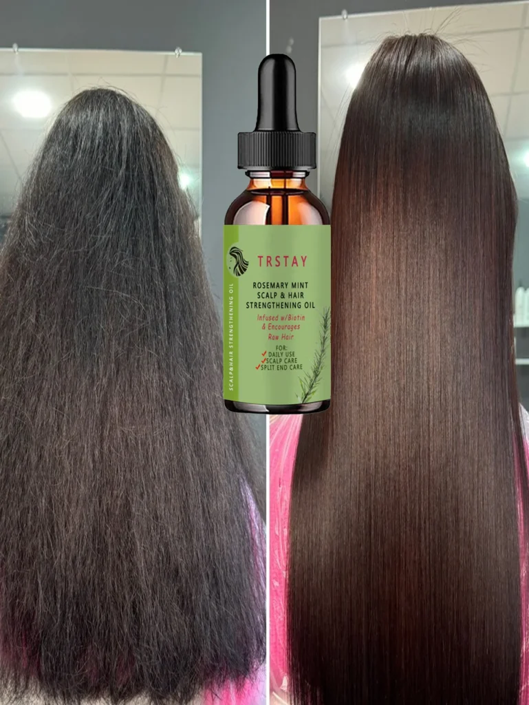 Effective Anti-Shedding Essential Oil for Thicker, Healthier Hair Growth