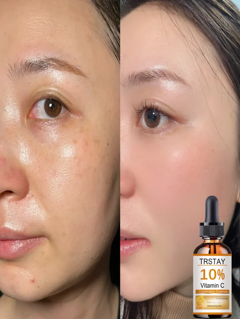 Discover the Best Alcohol-Free Facial Oil for Deep Hydration and Sensitive Skin